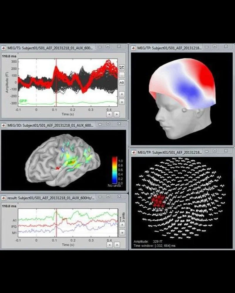 BEst Brainstorm — Python Wrapper